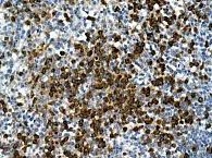 Immunohistochemistry (Formalin/PFA-fixed paraffin-embedded sections) - Anti-CD15 antibody [EPR9521] - BSA and Azide free (AB240171)