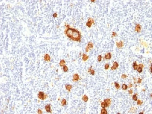 Immunohistochemistry (Formalin/PFA-fixed paraffin-embedded sections) - Anti-CD15 antibody [FUT4/815] (AB220182)