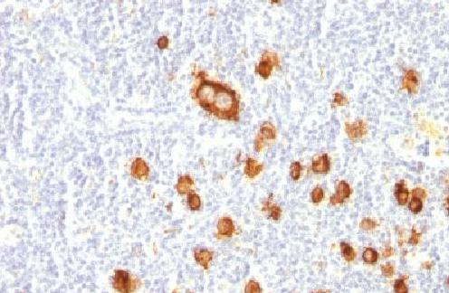 Immunohistochemistry (Formalin/PFA-fixed paraffin-embedded sections) - Anti-CD15 antibody [FUT4/815] - BSA and Azide free (AB212396)