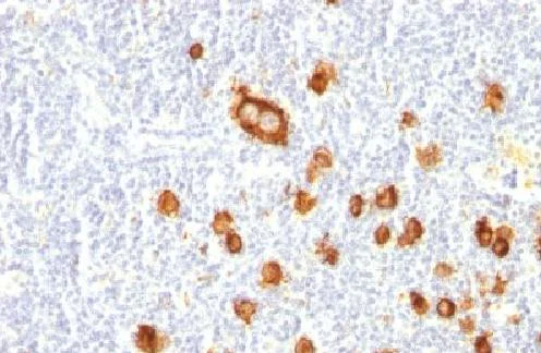Immunohistochemistry (Formalin/PFA-fixed paraffin-embedded sections) - Anti-CD15 antibody [FUT4/815] - BSA and Azide free (AB212396)