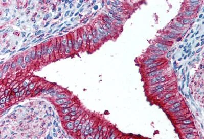 Immunohistochemistry (Formalin/PFA-fixed paraffin-embedded sections) - Anti-CD15 antibody [HI98] (AB188610)
