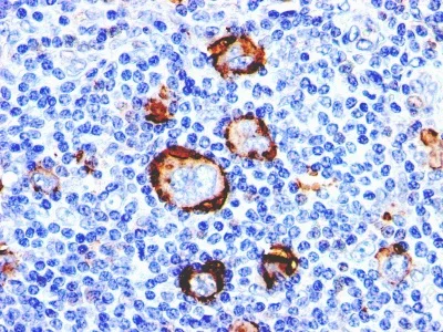 Immunohistochemistry (Formalin/PFA-fixed paraffin-embedded sections) - Anti-CD15 antibody [Leu-M1] (AB233867)