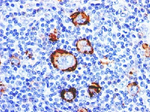 Immunohistochemistry (Formalin/PFA-fixed paraffin-embedded sections) - Anti-CD15 antibody [Leu-M1] - BSA and Azide free (AB212391), expandable thumbnail