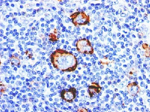 Immunohistochemistry (Formalin/PFA-fixed paraffin-embedded sections) - Anti-CD15 antibody [Leu-M1] - BSA and Azide free (AB212391)