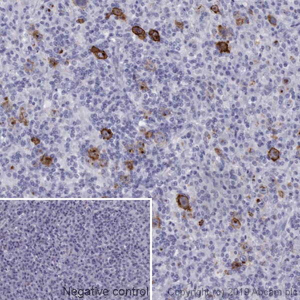 Immunohistochemistry (Formalin/PFA-fixed paraffin-embedded sections) - Anti-CD15 antibody [MMA] (AB17080)