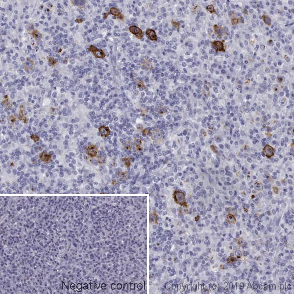 Immunohistochemistry (Formalin/PFA-fixed paraffin-embedded sections) - Anti-CD15 antibody [MMA] (AB17080)