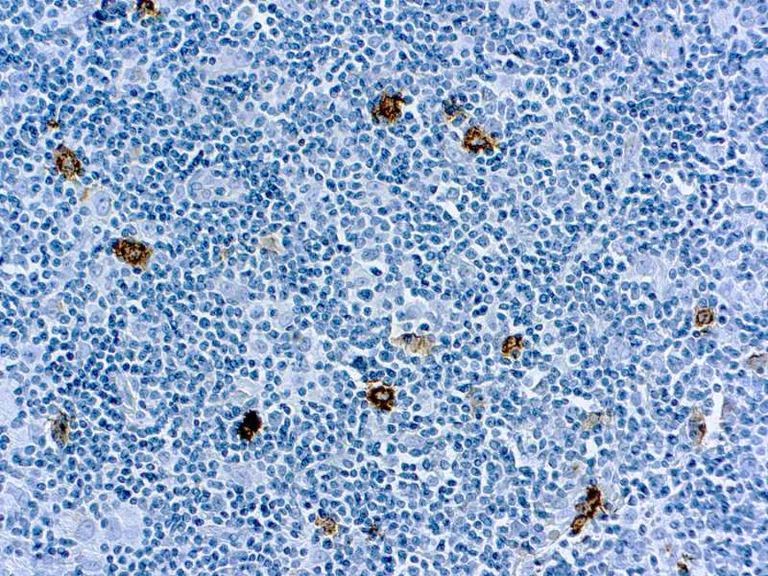 Immunohistochemistry (Formalin/PFA-fixed paraffin-embedded sections) - Anti-CD15 antibody [MMA], prediluted (AB7495)