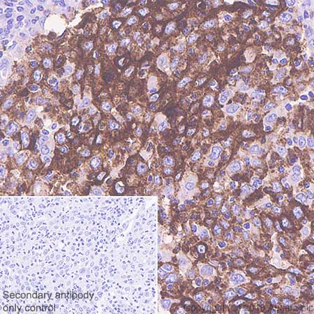 Immunohistochemistry (Formalin/PFA-fixed paraffin-embedded sections) - Anti-CD15 antibody [SP159] (AB135377), expandable thumbnail