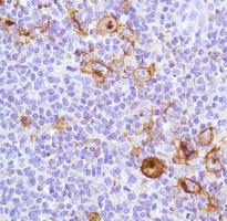 Immunohistochemistry (Formalin/PFA-fixed paraffin-embedded sections) - Anti-CD15 antibody [SP159] (ab135377), expandable thumbnail