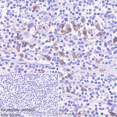 Immunohistochemistry (Formalin/PFA-fixed paraffin-embedded sections) - Anti-CD15 antibody [SP159] (AB135377), expandable thumbnail