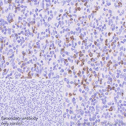 Immunohistochemistry (Formalin/PFA-fixed paraffin-embedded sections) - Anti-CD15 antibody [SP159] (AB135377), expandable thumbnail