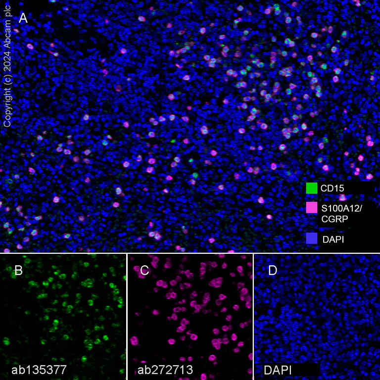 Multiplex immunohistochemistry - Anti-CD15 antibody [SP159] (AB135377)