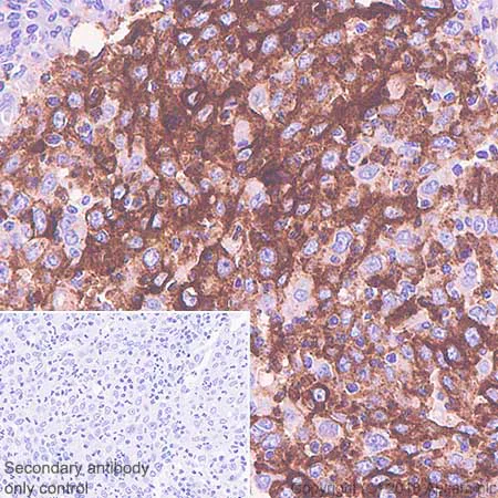 Immunohistochemistry (Formalin/PFA-fixed paraffin-embedded sections) - Anti-CD15 antibody [SP159] - BSA and Azide free (AB240092)