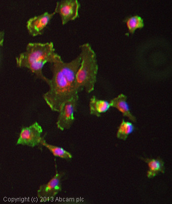 Immunocytochemistry/ Immunofluorescence - Anti-CD151 antibody [11G5a] (AB33315), expandable thumbnail