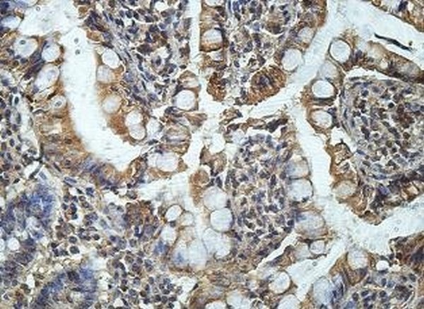 Immunohistochemistry (Formalin/PFA-fixed paraffin-embedded sections) - Anti-CD151 antibody (AB201174), expandable thumbnail
