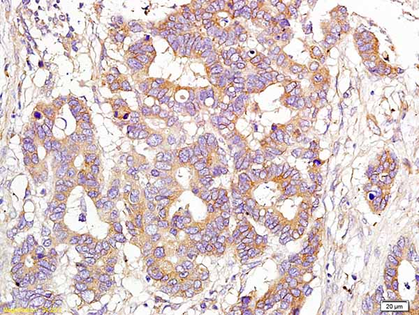 Immunohistochemistry (Formalin/PFA-fixed paraffin-embedded sections) - Anti-CD151 antibody (AB217357)