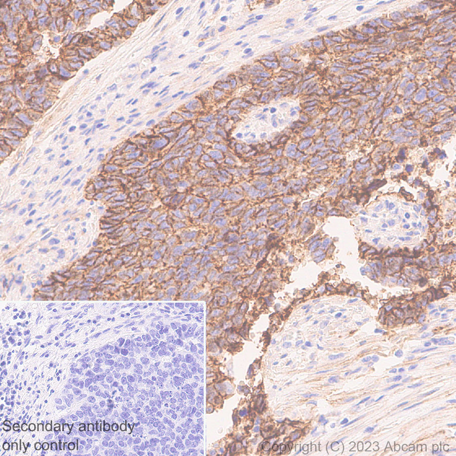 Immunohistochemistry (Formalin/PFA-fixed paraffin-embedded sections) - Anti-CD151 antibody [EPR27423-31] (ab309512), expandable thumbnail