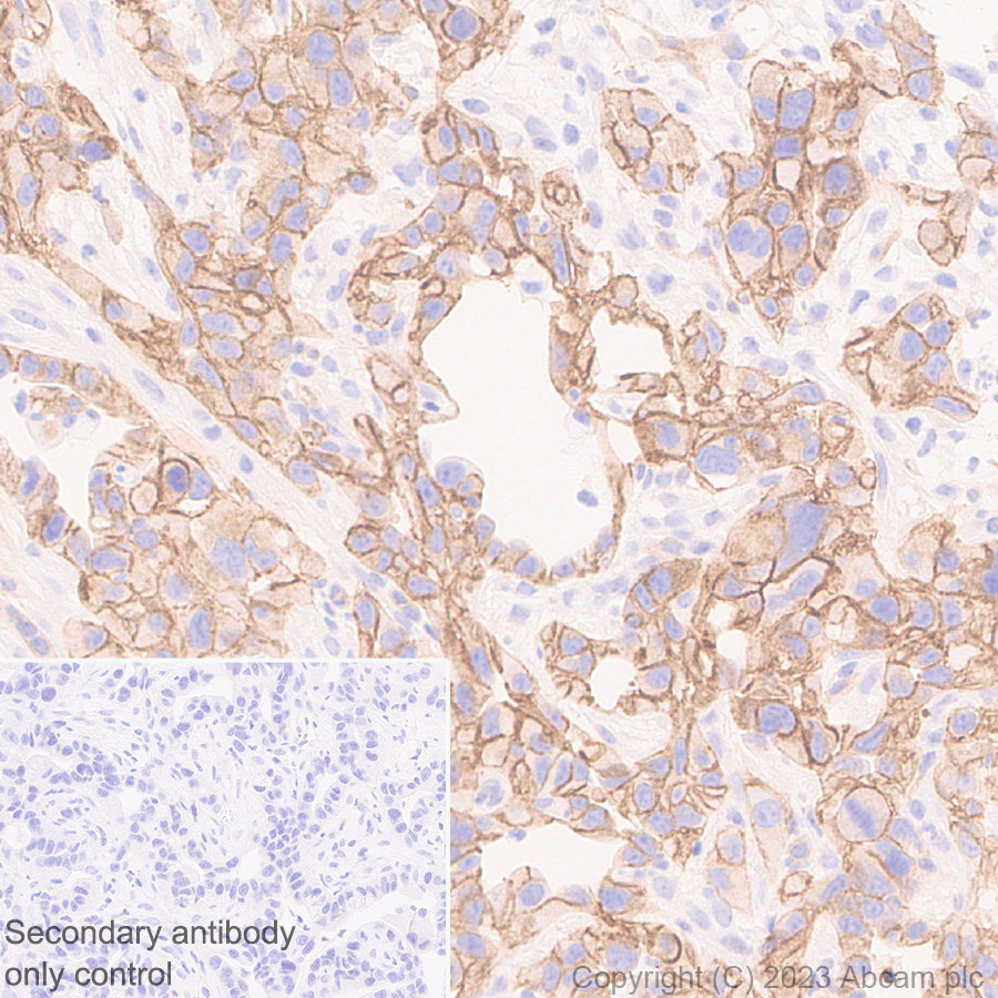 Immunohistochemistry (Formalin/PFA-fixed paraffin-embedded sections) - Anti-CD151 antibody [EPR27423-31] (ab309512), expandable thumbnail