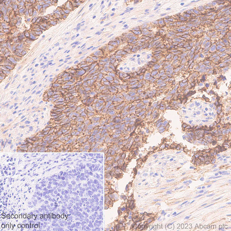 Immunohistochemistry (Formalin/PFA-fixed paraffin-embedded sections) - Anti-CD151 antibody [EPR27423-31] - BSA and Azide free (AB309513)
