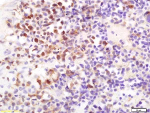 Immunohistochemistry (Formalin/PFA-fixed paraffin-embedded sections) - Anti-CD16 antibody (AB203883)