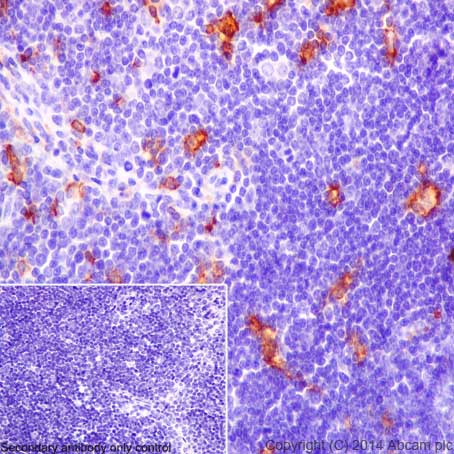 Immunohistochemistry (Formalin/PFA-fixed paraffin-embedded sections) - Anti-CD16 antibody [EPR16784] - C-terminal (AB198507), expandable thumbnail
