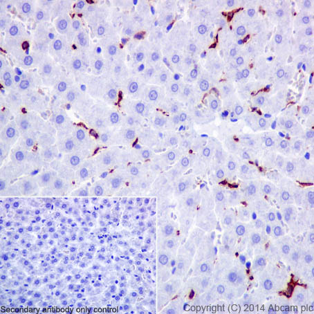 Immunohistochemistry (Formalin/PFA-fixed paraffin-embedded sections) - Anti-CD16 antibody [EPR16784] - C-terminal (AB198507), expandable thumbnail