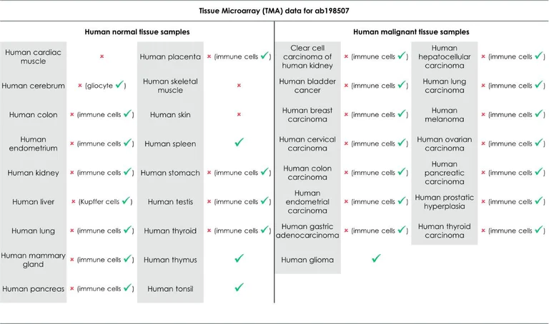 Immunohistochemistry (Formalin/PFA-fixed paraffin-embedded sections) - Anti-CD16 antibody [EPR16784] - Low endotoxin, Azide free (AB215977)