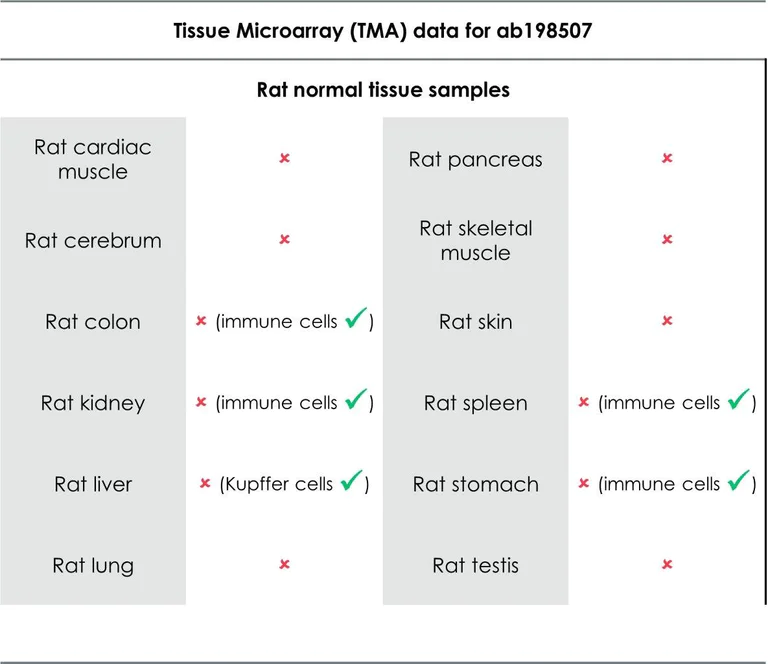 Immunohistochemistry (Formalin/PFA-fixed paraffin-embedded sections) - Anti-CD16 antibody [EPR16784] - Low endotoxin, Azide free (AB215977)