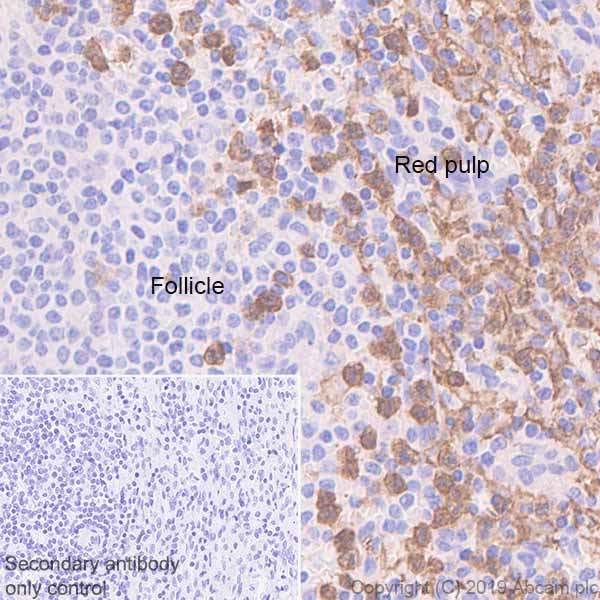 Immunohistochemistry (Formalin/PFA-fixed paraffin-embedded sections) - Anti-CD16 antibody [EPR22409-124] (AB246222), expandable thumbnail