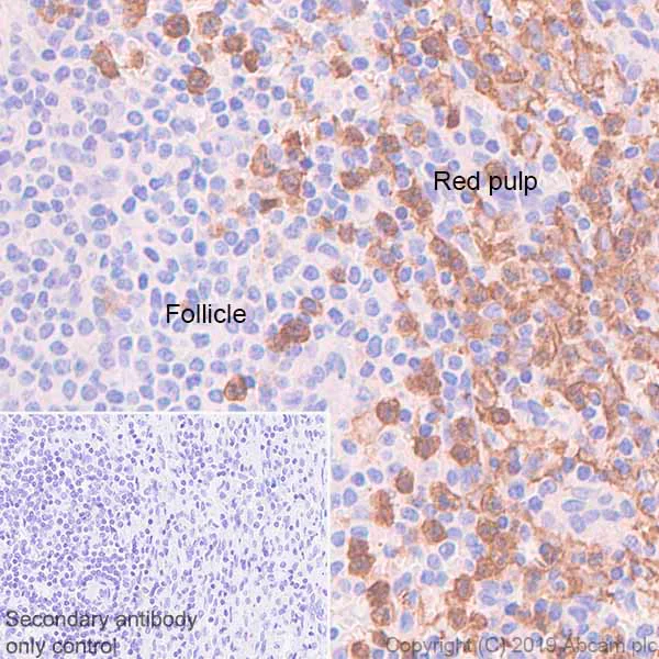 Immunohistochemistry (Formalin/PFA-fixed paraffin-embedded sections) - Anti-CD16 antibody [EPR22409-124] (AB246222)