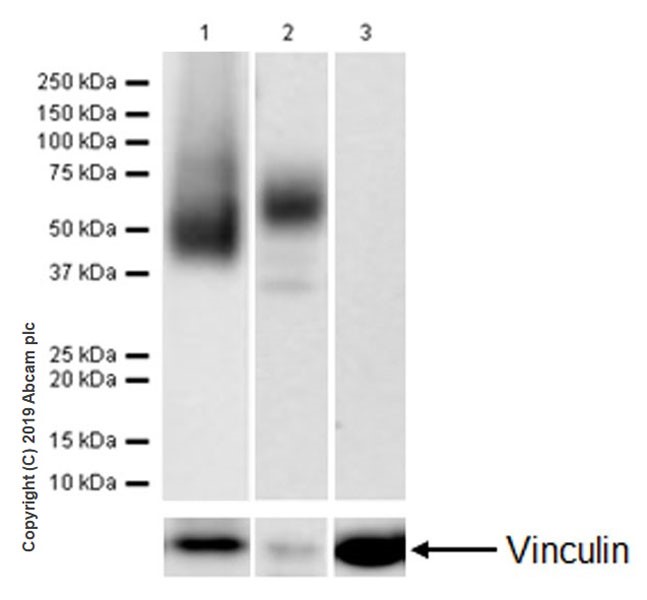Western blot - Anti-CD16 antibody [EPR22409-124] (AB246222), expandable thumbnail