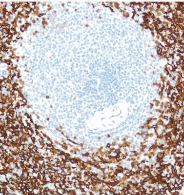 Immunohistochemistry (Formalin/PFA-fixed paraffin-embedded sections) - Anti-CD16 antibody [SP175] (AB183354)