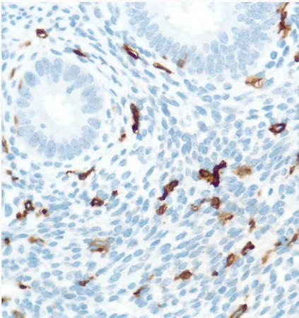 Immunohistochemistry (Formalin/PFA-fixed paraffin-embedded sections) - Anti-CD16 antibody [SP175] (AB183354)