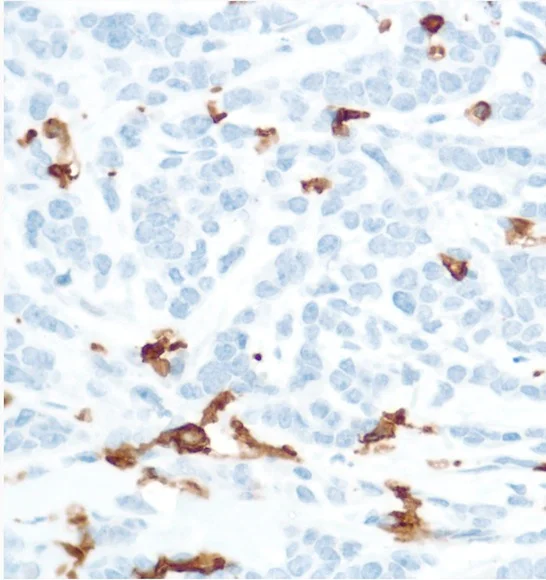 Immunohistochemistry (Formalin/PFA-fixed paraffin-embedded sections) - Anti-CD16 antibody [SP175] (AB183354)