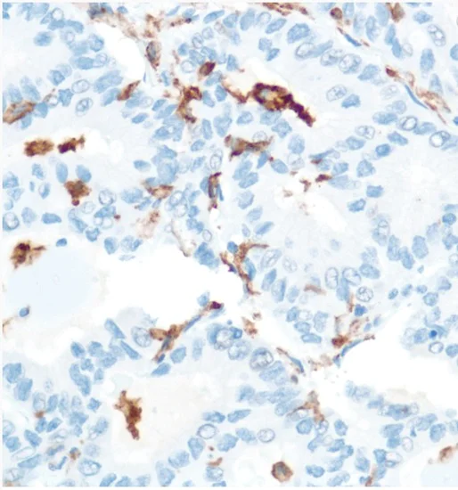 Immunohistochemistry (Formalin/PFA-fixed paraffin-embedded sections) - Anti-CD16 antibody [SP175] (AB183354)