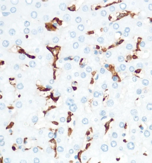 Immunohistochemistry (Formalin/PFA-fixed paraffin-embedded sections) - Anti-CD16 antibody [SP175] - BSA and Azide free (AB243925)