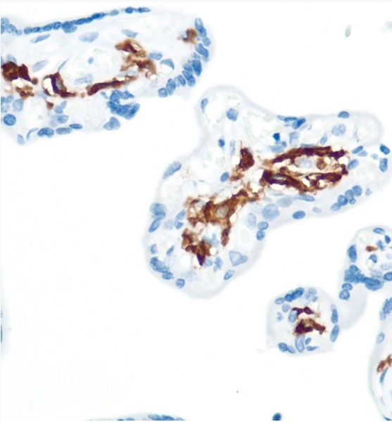 Immunohistochemistry (Formalin/PFA-fixed paraffin-embedded sections) - Anti-CD16 antibody [SP175] - BSA and Azide free (ab243925), expandable thumbnail
