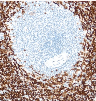 Immunohistochemistry (Formalin/PFA-fixed paraffin-embedded sections) - Anti-CD16 antibody [SP175] - BSA and Azide free (AB243925), expandable thumbnail
