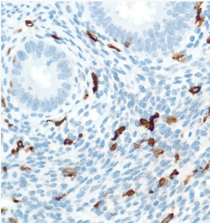Immunohistochemistry (Formalin/PFA-fixed paraffin-embedded sections) - Anti-CD16 antibody [SP175] - BSA and Azide free (ab243925), expandable thumbnail