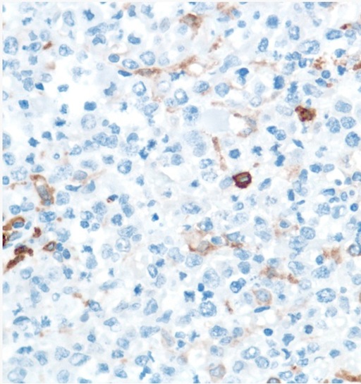 Immunohistochemistry (Formalin/PFA-fixed paraffin-embedded sections) - Anti-CD16 antibody [SP175] - BSA and Azide free (AB243925), expandable thumbnail