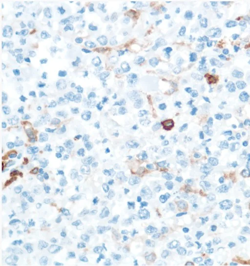Immunohistochemistry (Formalin/PFA-fixed paraffin-embedded sections) - Anti-CD16 antibody [SP175] - BSA and Azide free (AB243925)