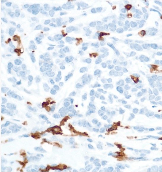 Immunohistochemistry (Formalin/PFA-fixed paraffin-embedded sections) - Anti-CD16 antibody [SP175] - BSA and Azide free (ab243925), expandable thumbnail