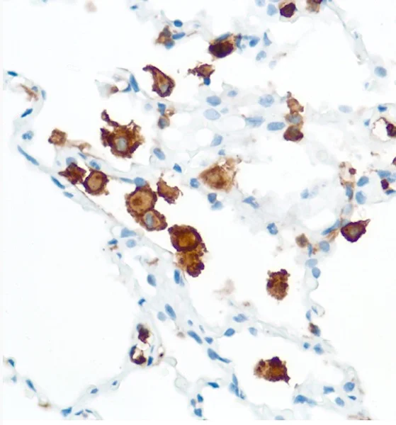 Immunohistochemistry (Formalin/PFA-fixed paraffin-embedded sections) - Anti-CD16 antibody [SP175] - BSA and Azide free (AB243925)