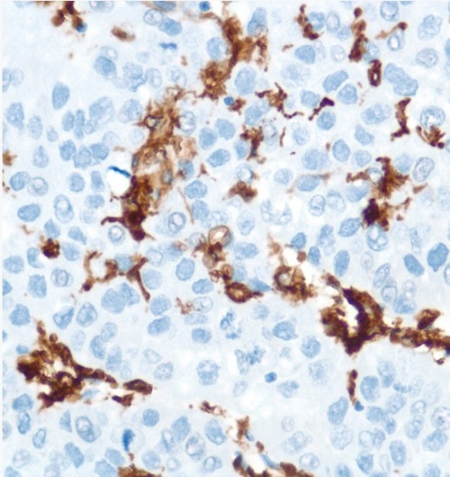 Immunohistochemistry (Formalin/PFA-fixed paraffin-embedded sections) - Anti-CD16 antibody [SP175] - BSA and Azide free (ab243925), expandable thumbnail