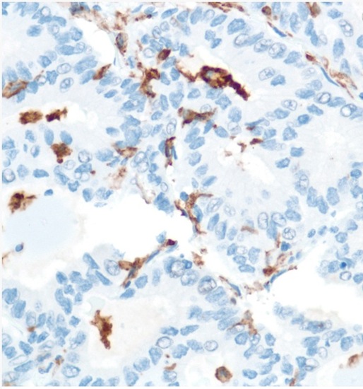 Immunohistochemistry (Formalin/PFA-fixed paraffin-embedded sections) - Anti-CD16 antibody [SP175] - BSA and Azide free (ab243925), expandable thumbnail