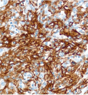 Immunohistochemistry (Formalin/PFA-fixed paraffin-embedded sections) - Anti-CD16 antibody [SP175] - BSA and Azide free (ab243925), expandable thumbnail