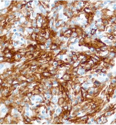 Immunohistochemistry (Formalin/PFA-fixed paraffin-embedded sections) - Anti-CD16 antibody [SP175] - BSA and Azide free (AB243925)