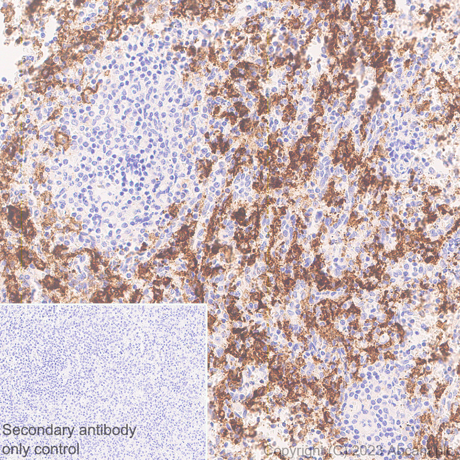 Immunohistochemistry (Formalin/PFA-fixed paraffin-embedded sections) - Anti-CD16 antibody [SP175] - Mouse IgG2a (Chimeric) (AB308605), expandable thumbnail