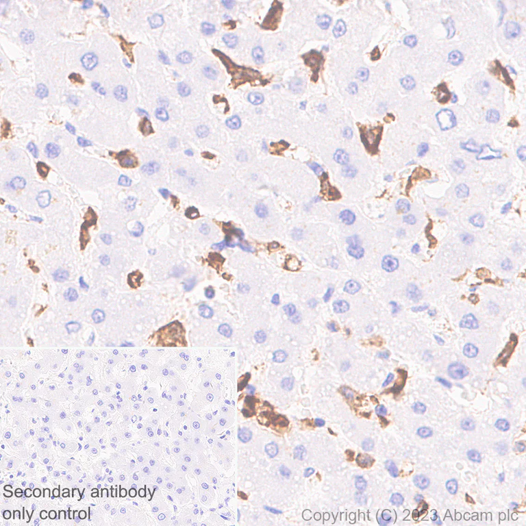 Immunohistochemistry (Formalin/PFA-fixed paraffin-embedded sections) - Anti-CD16 antibody [SP175] - Mouse IgG2a (Chimeric) - BSA and Azide free (AB308606)