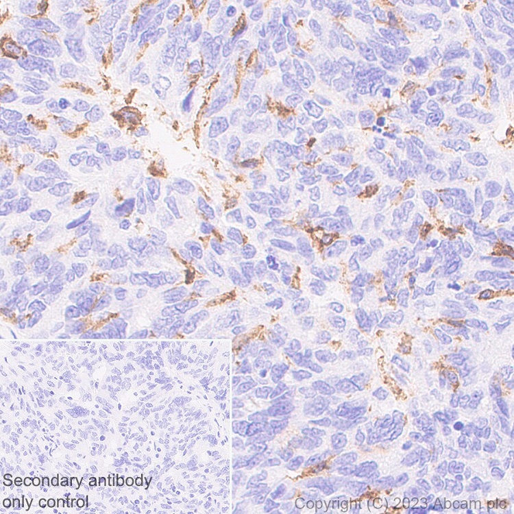 Immunohistochemistry (Formalin/PFA-fixed paraffin-embedded sections) - Anti-CD16 antibody [SP175] - Mouse IgG2a (Chimeric) - BSA and Azide free (AB308606), expandable thumbnail